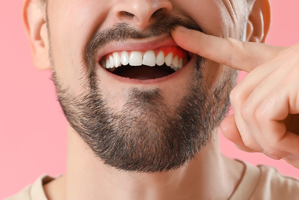 Prioritizing Your Oral Health: Why Periodontal Care is Essential at NuSmile Dental